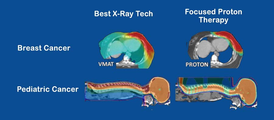 XRAYCOMARISON-GRAPHIC